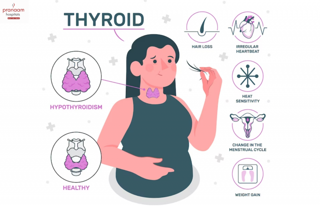 <p>A condition in which the <strong>thyroid gland produces too little thyroid hormone</strong>, slowing down the body’s metabolism.</p>