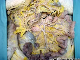 <p>what artery is being indicated to in the image?</p>
