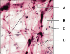 <p>A,B,C&D: composed of some type of ground substance embedded with protein fibers.</p>