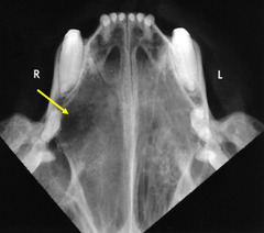 <p>Is this normal or abnormal?</p>