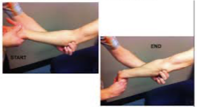 <p>Purpose</p><ul><li><p>Assess for medial epicondylitis/epicondylagia</p></li></ul><p>Position</p><ul><li><p>Sitting or standing</p></li></ul><p>Technique</p><ul><li><p>Examiner palpate medial epicondyle of the humerus while supporting elbow with one hand</p></li><li><p>Examiner’s other hand passively supinates the patient’s forearm and fully extends the elbow, wrist, and fingers</p></li></ul><p>Interpretation</p><ul><li><p>(-): patient experiences no pain</p></li><li><p>(+): patient has sudden pain or discomfort along the medial aspect of the elbow or in the region of the medial epicondyle suggestive of medial epicondylitis</p></li></ul><p></p><p></p>