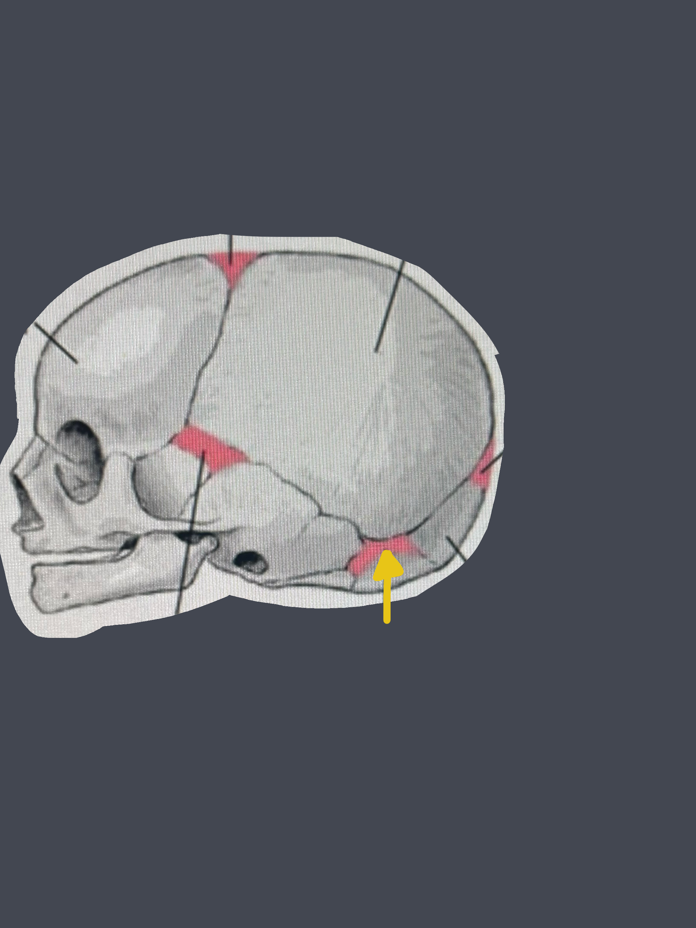 term image