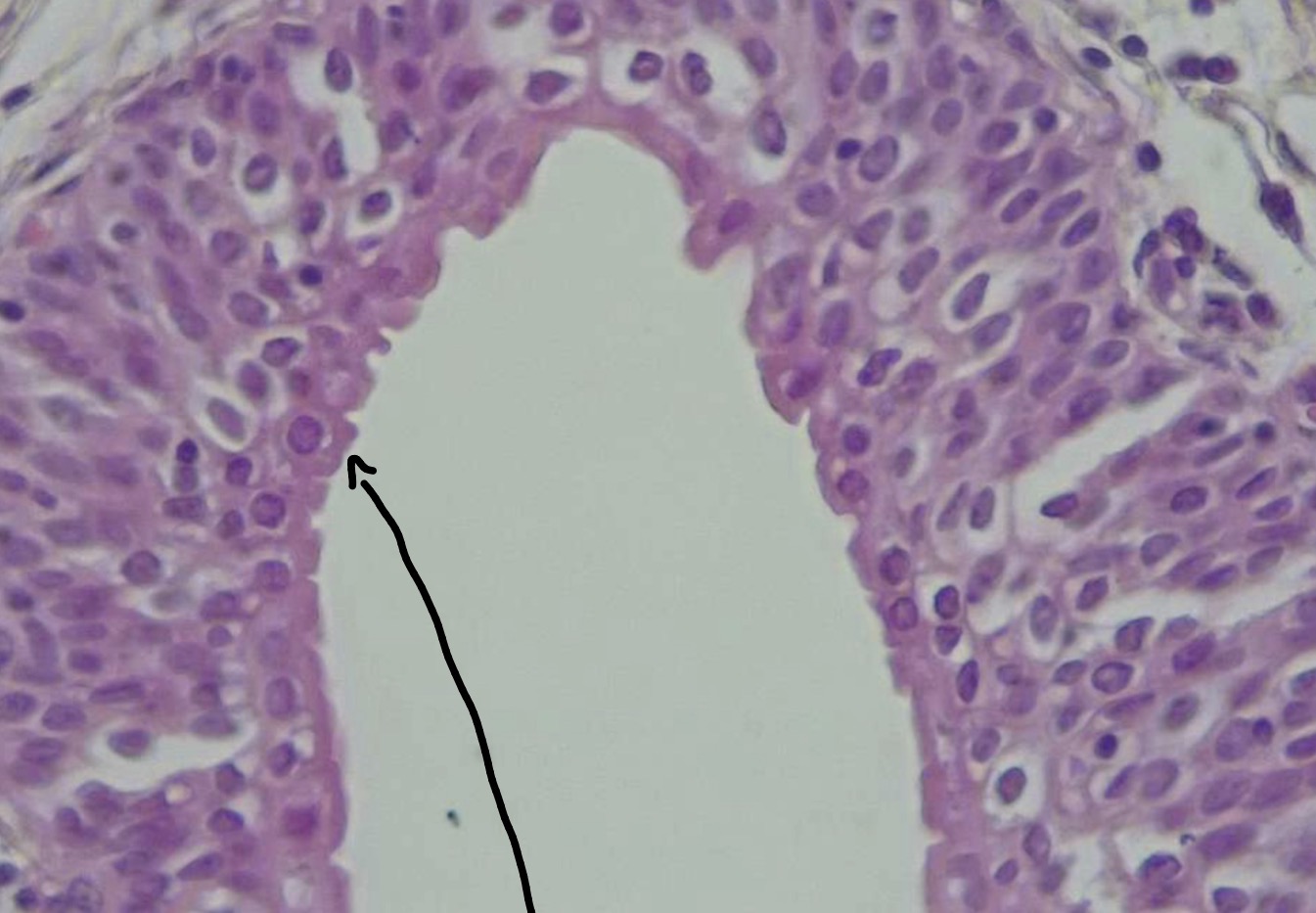term image