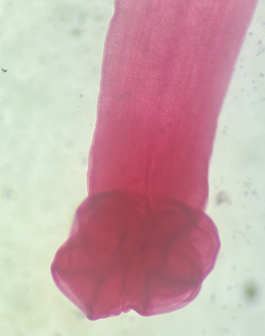 <p>What phylum and class is this?</p>