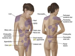 <p>Inflammation of gallbladder due to gallstone blockage.</p>