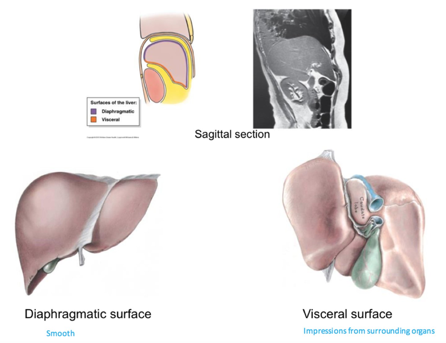 <p>- diaphragmatic - smooth posterior surface, covered w/ peritoneum except "bare area" where the diaphragm attaches (movement of diaphragm = movement of liver)</p><p>- visceral - anterior, sharper, angular margins, functional areas where filtration occurs, covered w/ peritoneum except where porta hepatis and gallbladder attach</p>