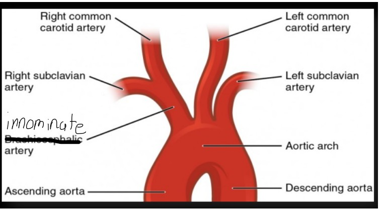 <p>- Innominate Artery </p><p>-- splits into right common carotid Artery & right subclavian Artery </p><p>- Left common carotid </p><p>- Left subclavian</p>