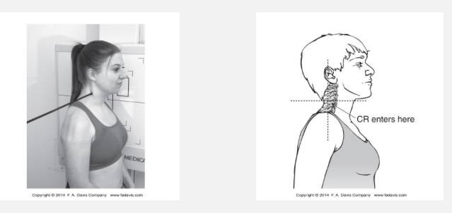 <p>What structures are visualized on a lateral cervical spine radiograph?</p>