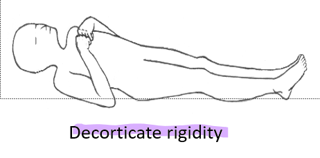 <p>Decorticate</p>