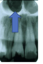 <p>Nasal Cavity/Fossa</p>