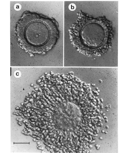 <ul><li><p><span style="font-family: Calibri, sans-serif; line-height: 107%;">cumulus cell expansion in an indirect indicator of oocyte maturation.</span></p></li><li><p><span style="font-family: Calibri, sans-serif; line-height: 107%;">appreciation of the presence of a polar body indicating that the oocyte has reached metaphase II</span></p></li></ul><p></p>