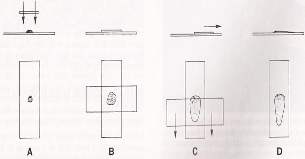 <p>» Place one slide over the other at right angles</p><p></p><p>» Gently pull the two slides apart</p><p></p><p>» Minimal pressure on the slides,</p><p>• too much pressure -> cell rupture-> non-diagnostic sample</p>
