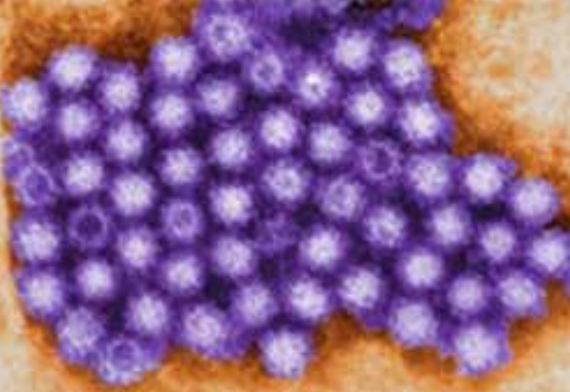<p>Describe the <strong>Source </strong>of this waterborne virus:</p><p>-<strong>Calcivirus</strong></p>
