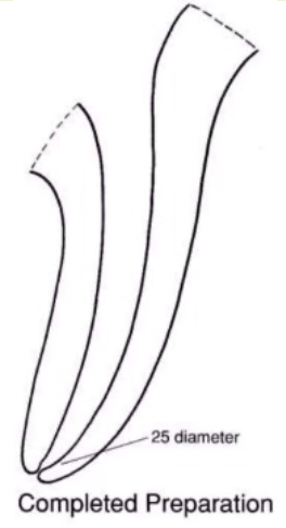 <p><span>final form with smooth taper</span></p><p><span>able to prepare the apical stop</span></p>