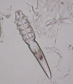 <ul><li><p>name</p></li><li><p>host</p></li><li><p>infection site</p></li><li><p>diseases transmitted</p></li></ul><p></p>