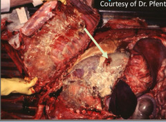 <p>What is the prognosis like for an animal with a penetrating chest wound like this?</p>