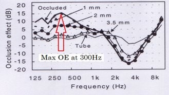 <p>what frequency does occlusion effect impact the most?</p>