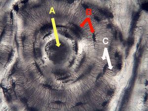 <ul><li><p><em>Characteristic Feature: </em>surrounded by <strong>osteocytes </strong>- bone cells made of fibrous, crystalline extracellular matrix&nbsp;</p></li><li><p><em>Cell shape/Characteristics:</em> looks like the rings or bark of a tree</p></li><li><p><em>Function:</em> protects internal organs, provides rigid support for muscle attachment</p></li><li><p><em>Location:</em> Most of the skeleton</p><p>A is Haversian Canal-contain blood and nerves vessels</p><p>B is Lacuna- cavities in the cartilage where chondrocytes reside</p><p>C is Canaliculi- tiny passages that allow chondrocytes in lacunae to communicate with other cells</p></li></ul><p></p>