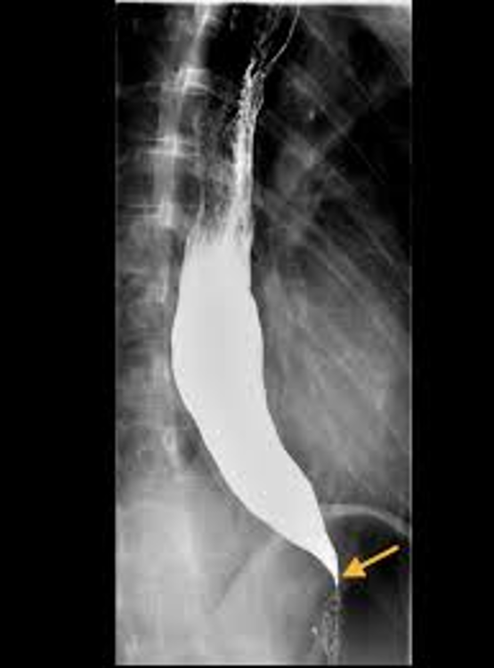 <p>diagnosis + sign</p>