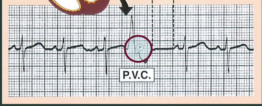 <p>What are the dotted lines showing?</p>