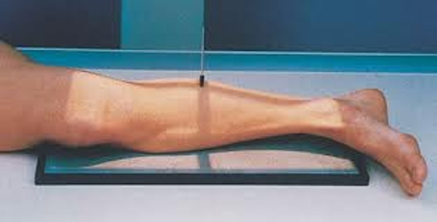 <p>S - on lap</p><p>T - 5 mAs @ 60 kVp</p><p>A - none</p><p>M - correct leg, on cassette</p><p>P - "sleeping position", patella straight out, CR midshaft</p><p>S - 40"</p><p>B - hold</p><p>C - 14 x 17, L</p>