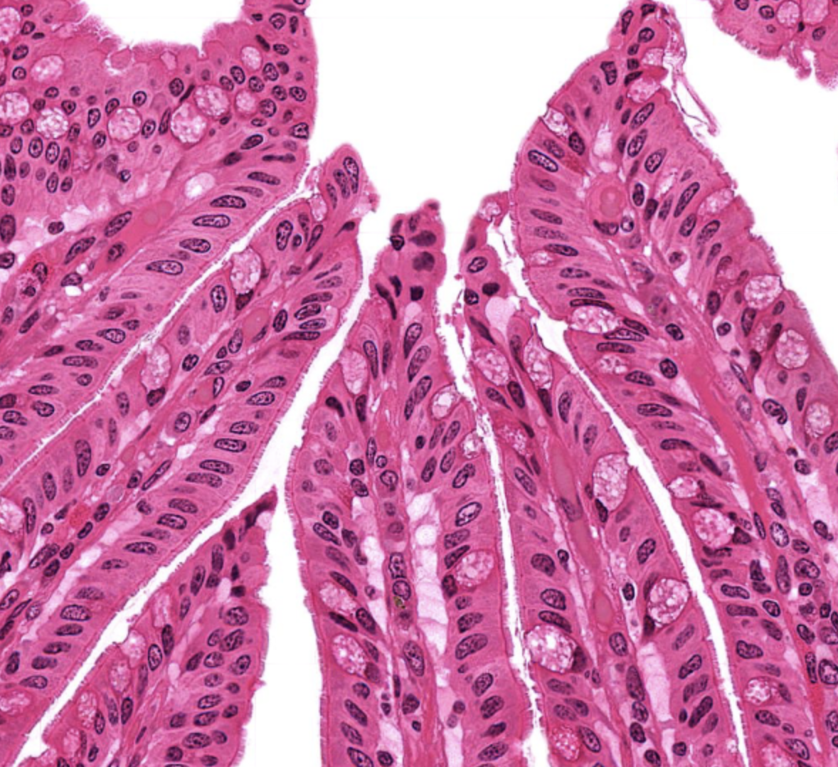 <p>tissue type</p>