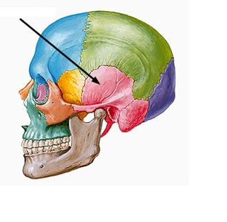 <p><strong>Lateral region</strong> of the <strong>temporal bone</strong> bordering the squamous suture</p>