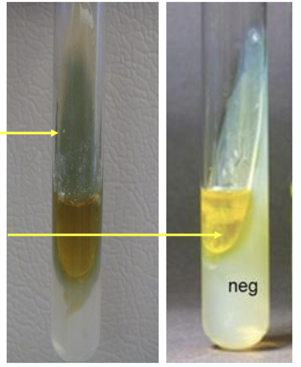 <p>left side <strong>bacteria GENUS name</strong>?</p>