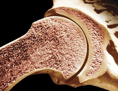 <p>Composed of small bars of bone and many open spaces.</p>