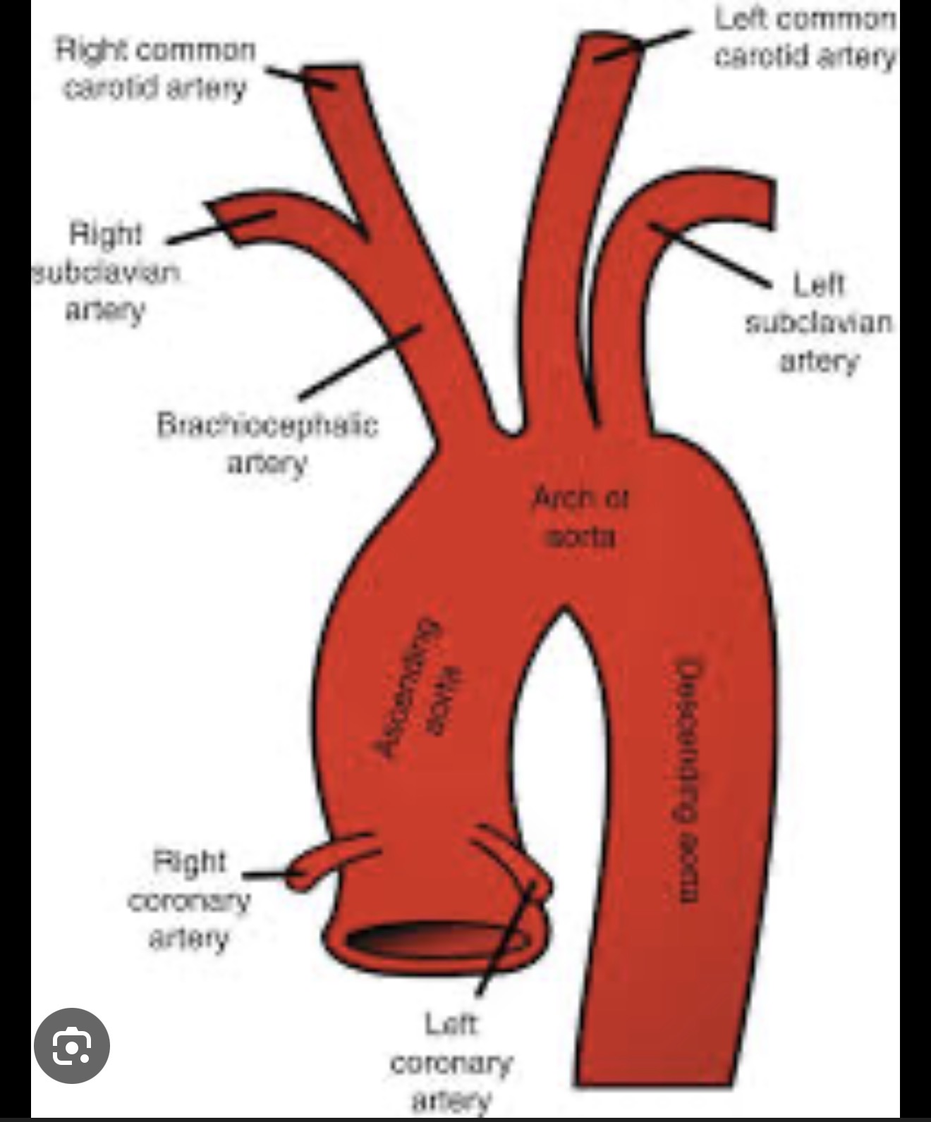 <p></p><ol><li><p><span><span>Brachiocephalic trunk → splits into:</span><span><br></span></span></p><ul><li><p><span><span>Right subclavian → right upper limb</span></span></p></li><li><p><span><span>Right common carotid → right head &amp; neck</span></span></p></li></ul></li><li><p></p></li><li><p><span><span>Left common carotid → left head &amp; neck</span></span></p></li><li><p><span><span>Left subclavian → left upper limb</span></span></p></li></ol><p></p>