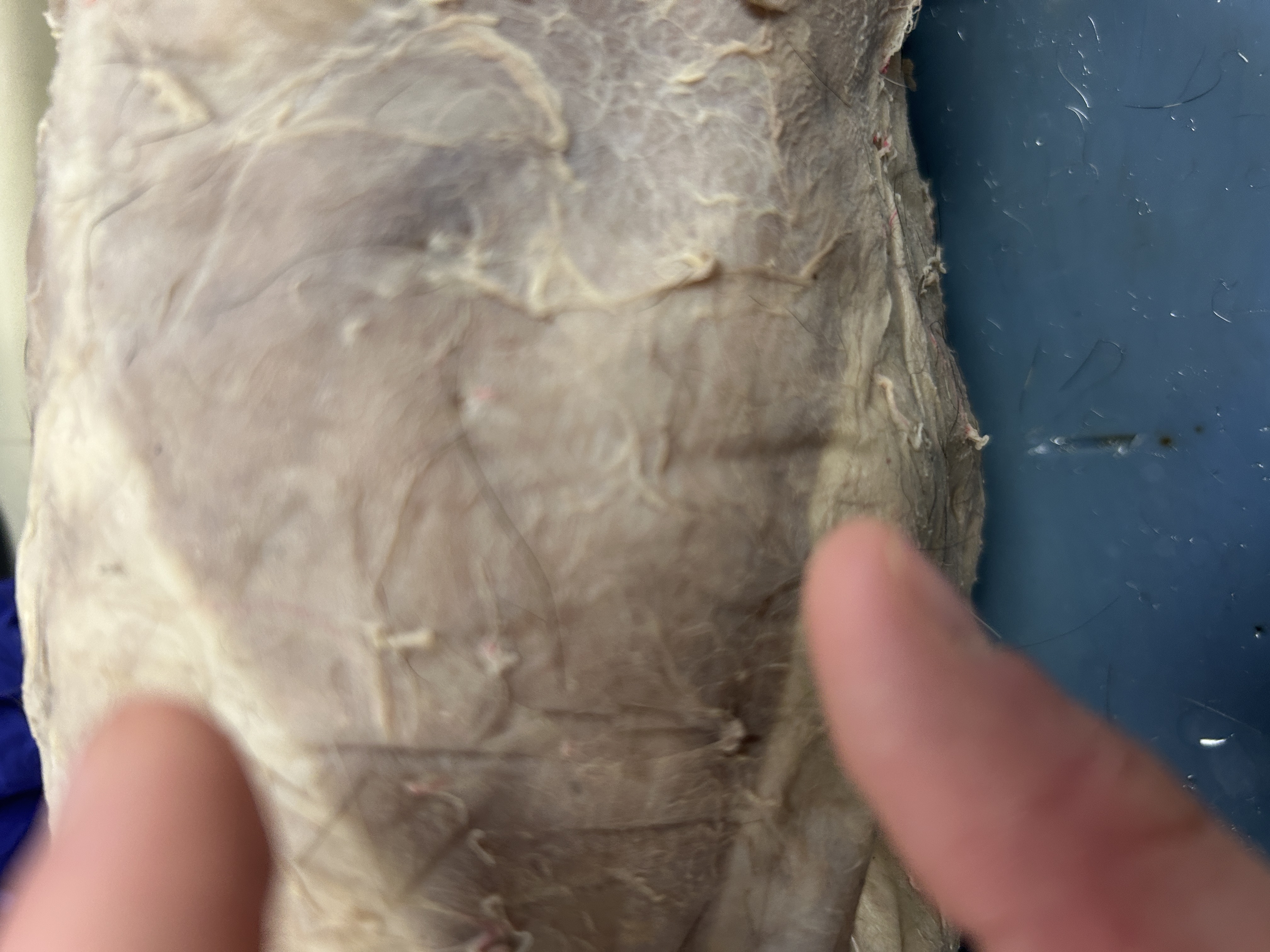 <p>Latissimus dorsi(giant v shape muscle side of back)</p>