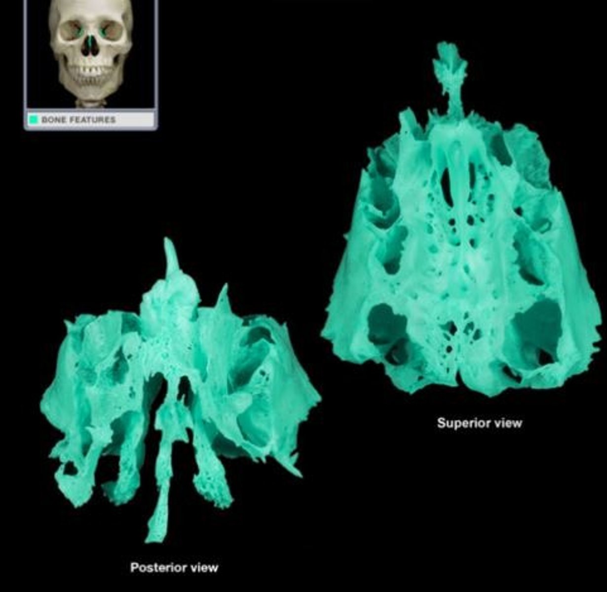 <p>What bone is this?</p>