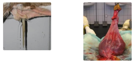 <p>Urachal cyst/fistula</p>