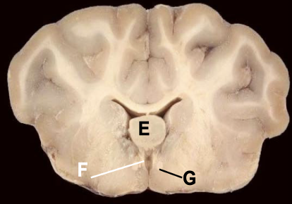 <p>F</p>