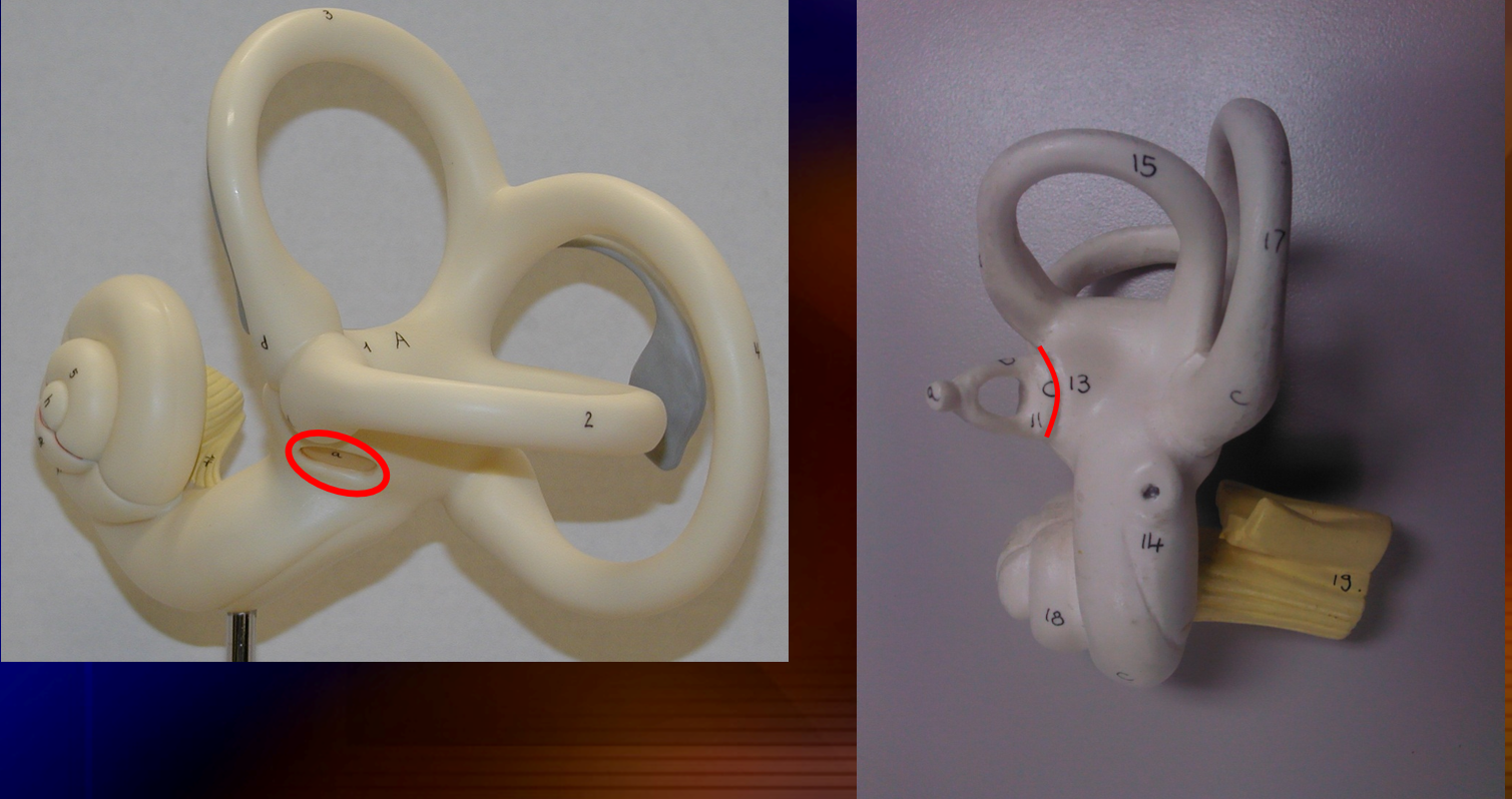 <p>behind the stapes </p>