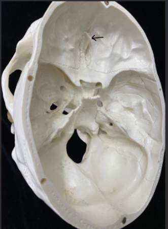 <p>What bone is this?</p>