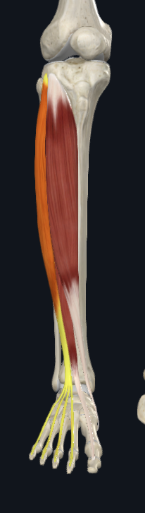 <p>what does this following muscle proximally attach to?</p>