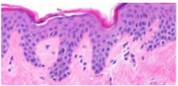 <p>Q: what type of epithelium is this?</p>