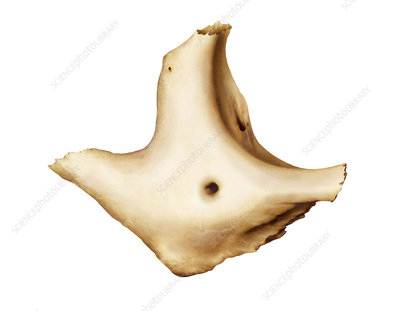 <p>what bone is this?</p>