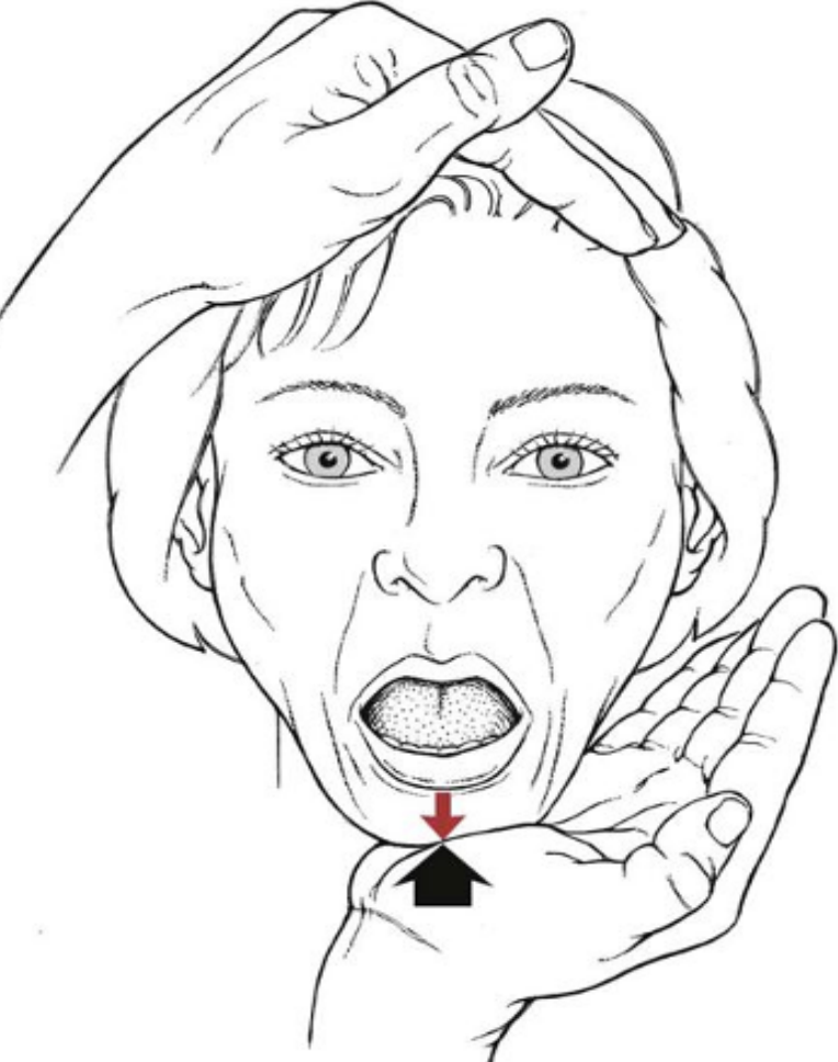 <p>• Resistance is applied to the jaw opening movement to test the supra-hyoid and infrahyoid muscles</p>