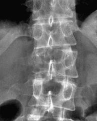 <p>What is this?</p><p>- MC in Mets</p><p>- Lower T/S & L/S</p>
