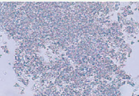 <ul><li><p>common in alkaline urine</p></li></ul><p></p>