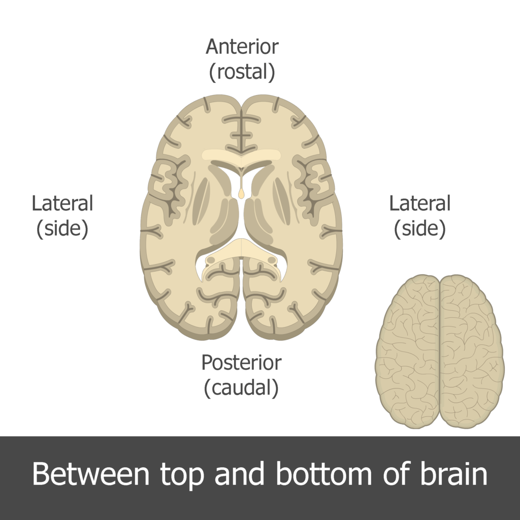 <p>cross section</p>