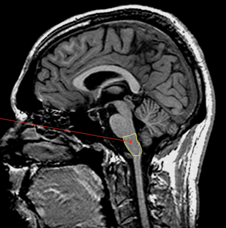 <p>What is the area highlighted called?</p>