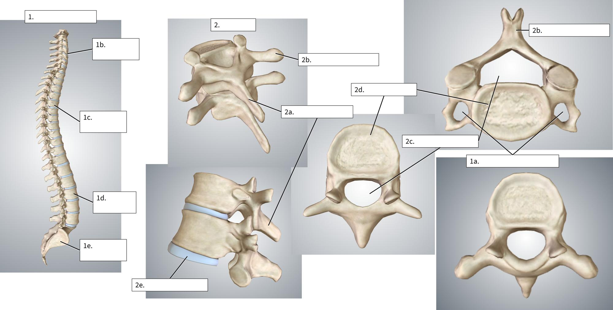 <p>1b. </p>