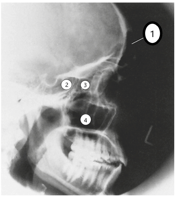 <p>label this image</p>