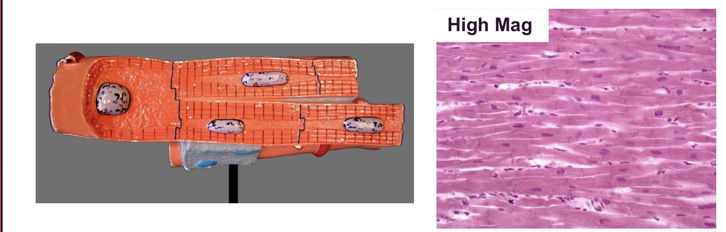 <p>A type of muscle found in the heart that features striations, nuclei, and intercalated discs.</p>