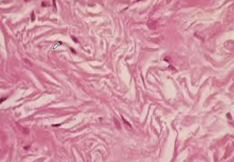 <p>Example of irregular ct</p>