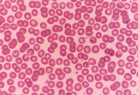 <p>Blood</p>