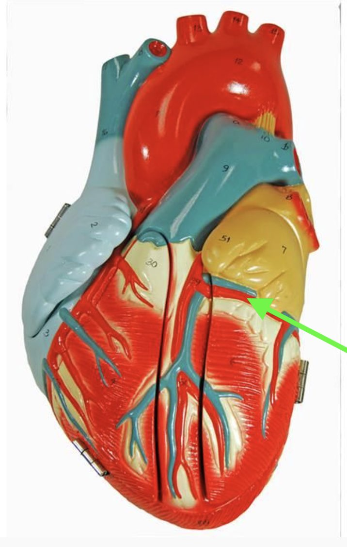 <p><span><strong>Identify the indicated vessel.</strong></span></p>